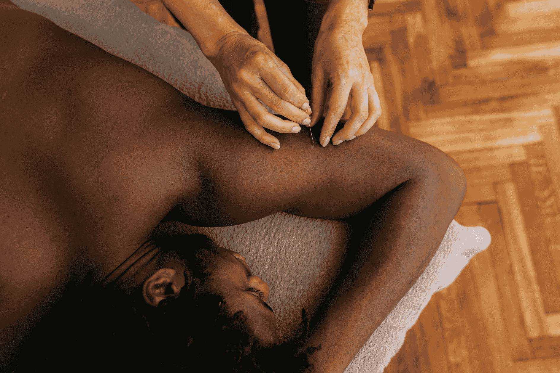 The Durand Clinic — Acupuncture needle treatment